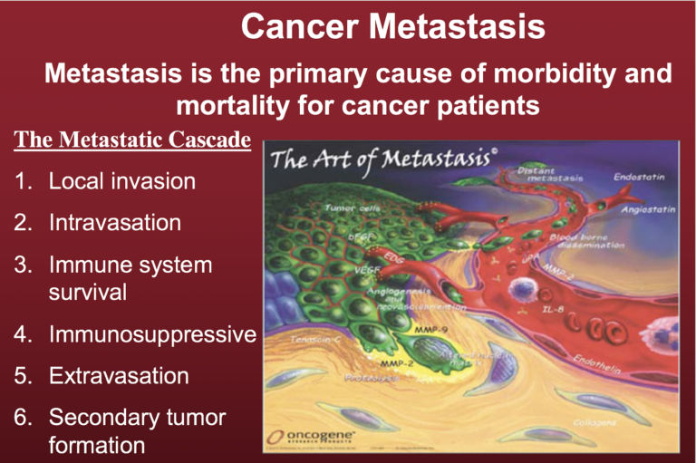 cancer metastasis