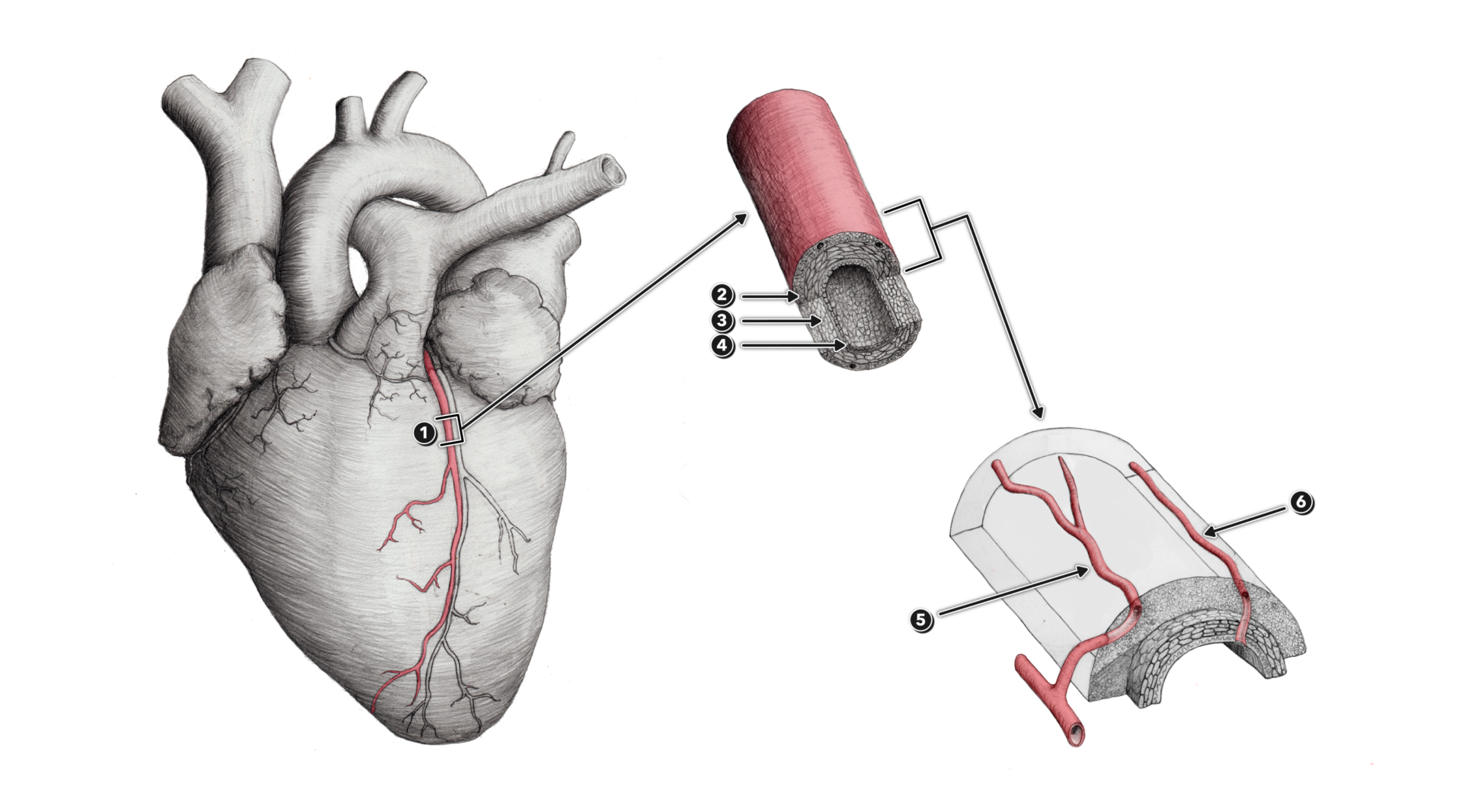 CrossFit The Vasa Vasorum