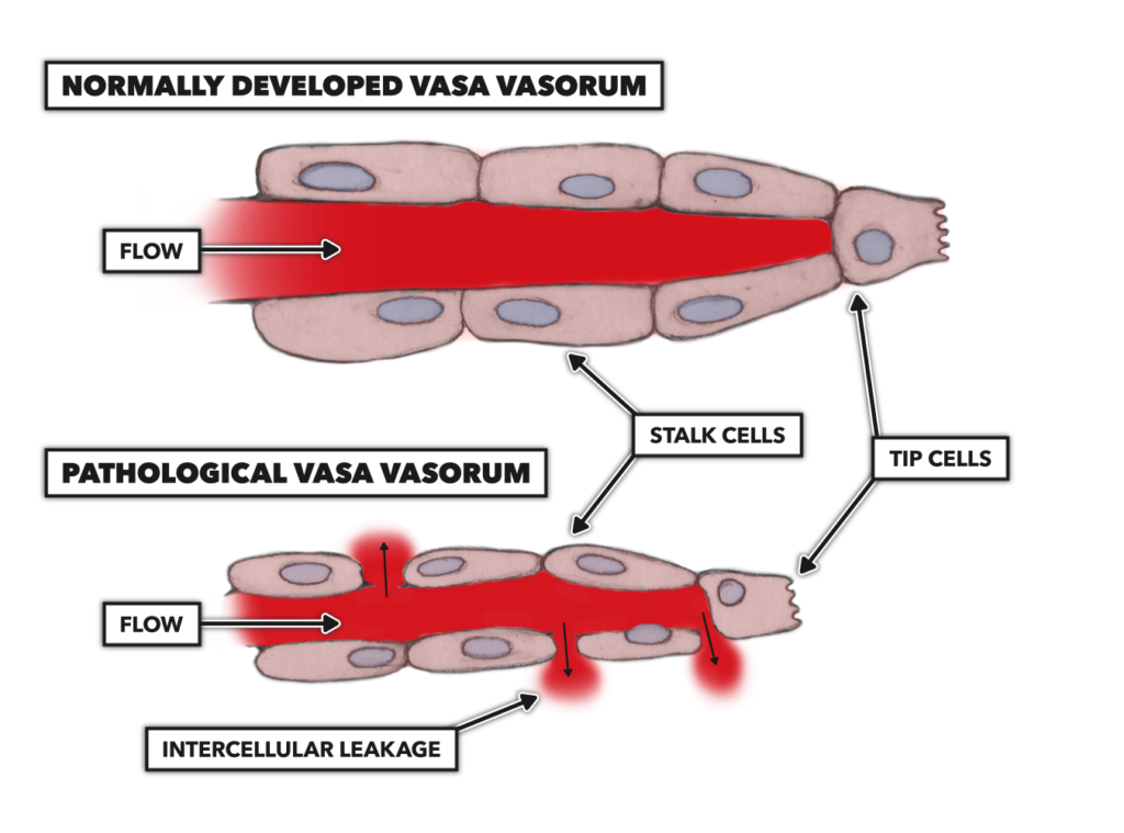 CrossFit The Vasa Vasorum