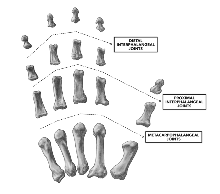 interphalangeal and metacarpophalangeal