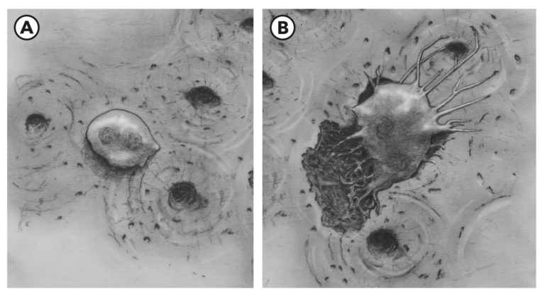 Osteoclast