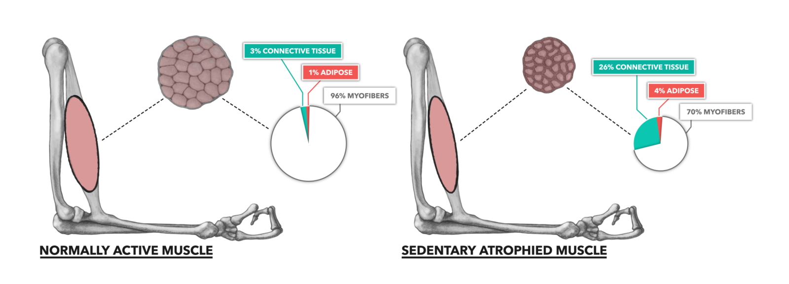 CrossFit Muscle Basics, Part 4 Atrophy & Sarcopenia