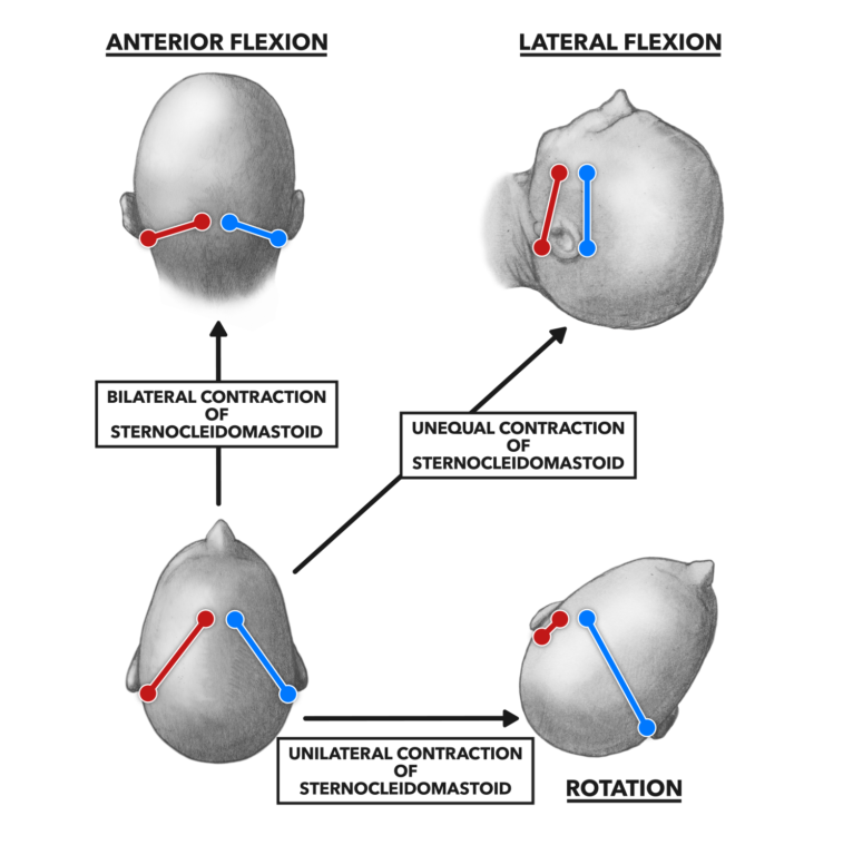 Anterior cervical