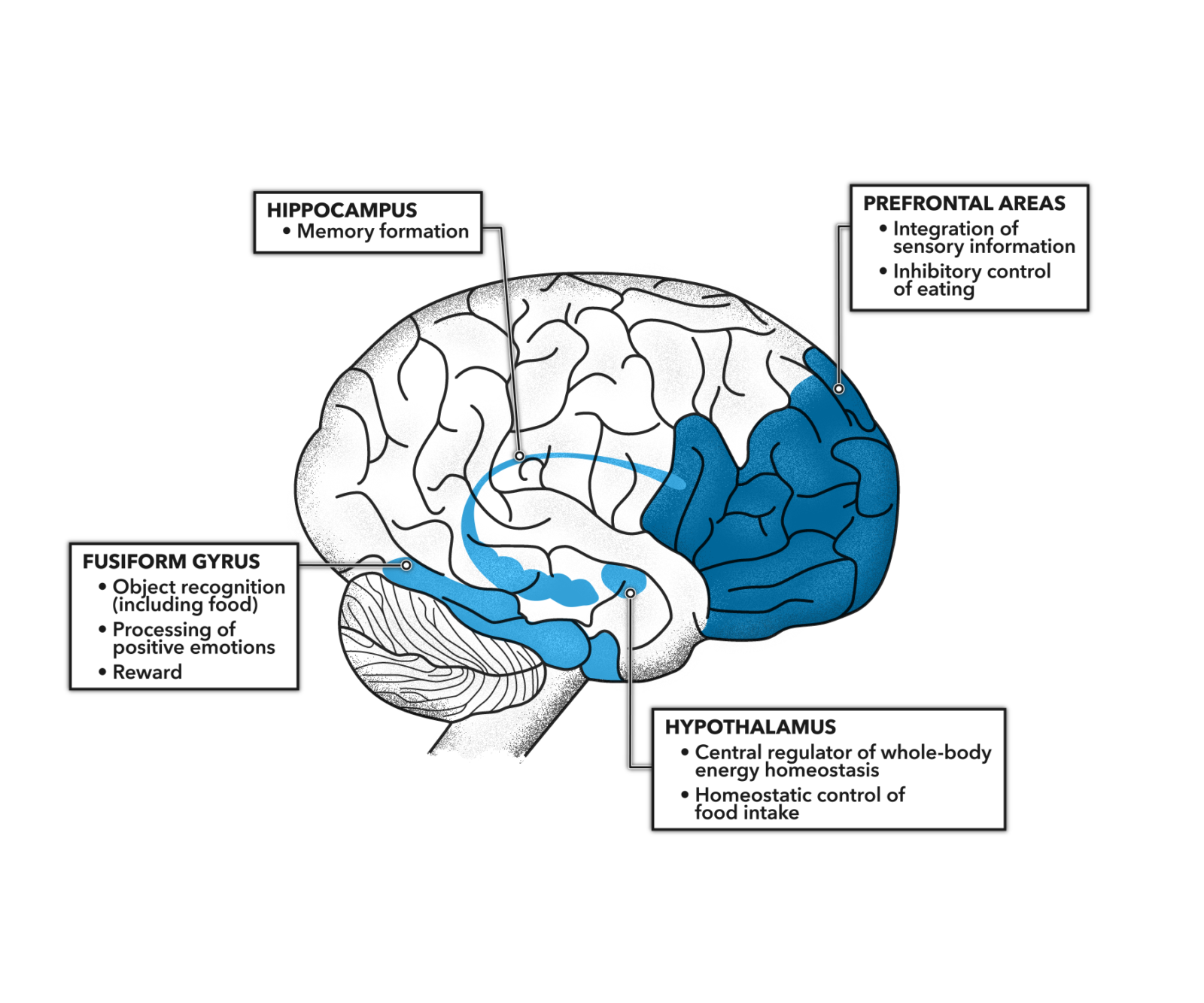 CrossFit | Impaired Insulin Action in the Human Brain: Causes and ...