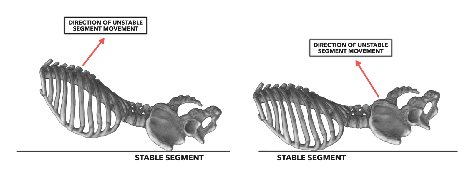 CrossFit Vertebral Arching and Rounding