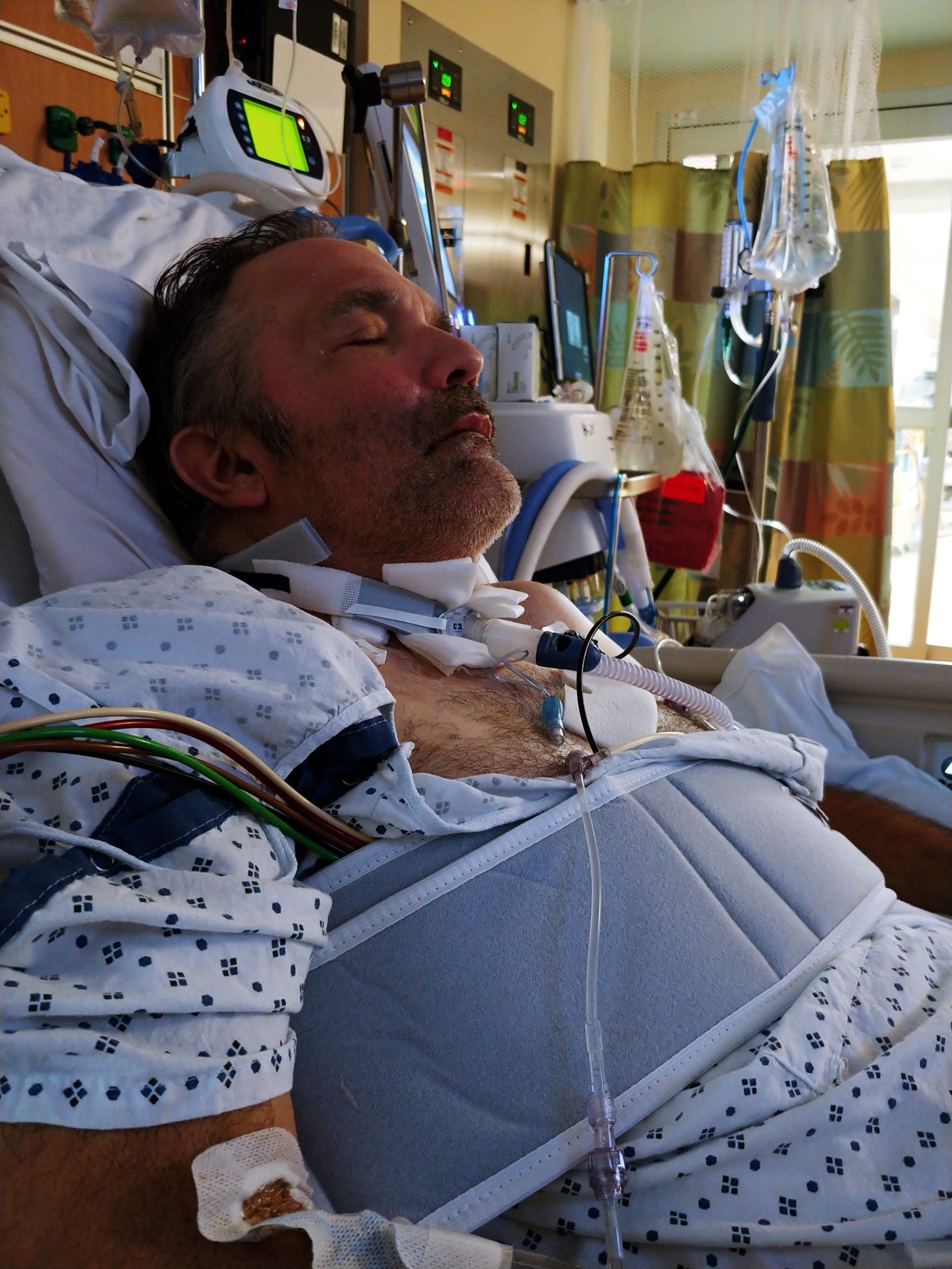 Rufus Brown in hospital on ECMO machine.